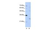 EXOSC4 Antibody in Western Blot (WB)