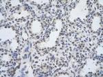 DDX17 Antibody in Immunohistochemistry (Paraffin) (IHC (P))