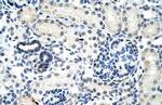 DDX17 Antibody in Immunohistochemistry (Paraffin) (IHC (P))