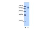 DDX17 Antibody in Western Blot (WB)