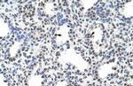 FUSIP1 Antibody in Immunohistochemistry (Paraffin) (IHC (P))