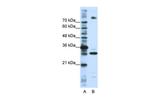 FUSIP1 Antibody in Western Blot (WB)