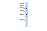 RPUSD2 Antibody in Western Blot (WB)