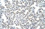 hnRNP A3 Antibody in Immunohistochemistry (Paraffin) (IHC (P))