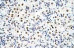 hnRNP A3 Antibody in Immunohistochemistry (Paraffin) (IHC (P))