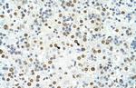 hnRNP A3 Antibody in Immunohistochemistry (Paraffin) (IHC (P))