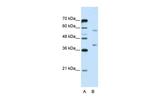 hnRNP A3 Antibody in Western Blot (WB)