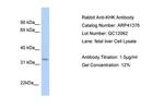 KHK Antibody in Western Blot (WB)