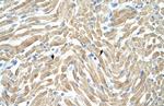 TPM1 Antibody in Immunohistochemistry (Paraffin) (IHC (P))