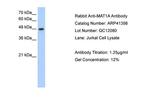 MAT1A Antibody in Western Blot (WB)