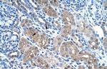 FBP1 Antibody in Immunohistochemistry (Paraffin) (IHC (P))