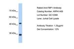 FBP1 Antibody in Western Blot (WB)