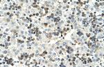 HSD17B6 Antibody in Immunohistochemistry (Paraffin) (IHC (P))