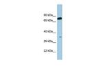 SDS Antibody in Western Blot (WB)