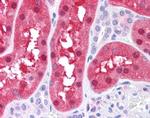 FAH Antibody in Immunohistochemistry (IHC)