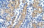 HSD17B1 Antibody in Immunohistochemistry (Paraffin) (IHC (P))