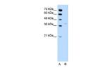 HSD17B1 Antibody in Western Blot (WB)