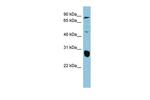 SLC26A4 Antibody in Western Blot (WB)