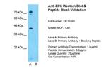 EPX Antibody in Western Blot (WB)