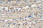 GSTM2 Antibody in Immunohistochemistry (Paraffin) (IHC (P))