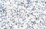 FECH Antibody in Immunohistochemistry (Paraffin) (IHC (P))