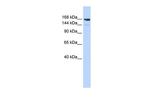 Periplakin Antibody in Western Blot (WB)