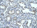 SQLE Antibody in Immunohistochemistry (Paraffin) (IHC (P))