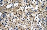 SQLE Antibody in Immunohistochemistry (Paraffin) (IHC (P))