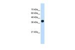 SQLE Antibody in Western Blot (WB)