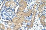 Troponin I Antibody in Immunohistochemistry (Paraffin) (IHC (P))