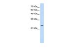 Troponin I Antibody in Western Blot (WB)