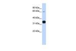 TNNT1 Antibody in Western Blot (WB)