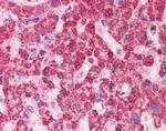 TST Antibody in Immunohistochemistry (Paraffin) (IHC (P))