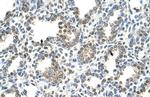 TST Antibody in Immunohistochemistry (Paraffin) (IHC (P))