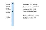 TST Antibody in Western Blot (WB)