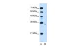 PPAP2A Antibody in Western Blot (WB)