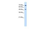 RAD23A Antibody in Western Blot (WB)