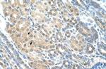 RAD23A Antibody in Immunohistochemistry (Paraffin) (IHC (P))