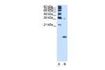 HBZ Antibody in Western Blot (WB)