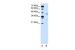 GPR161 Antibody in Western Blot (WB)