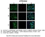 ATP6V0A2 Antibody in Immunocytochemistry (ICC/IF)