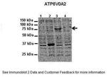 ATP6V0A2 Antibody in Western Blot (WB)