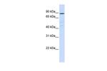 ATP6V0A2 Antibody in Western Blot (WB)