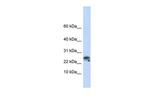 Granulysin Antibody in Western Blot (WB)