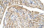 FADS1 Antibody in Immunohistochemistry (IHC)