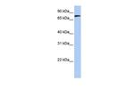 MFN2 Antibody in Western Blot (WB)