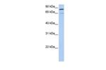 MFN2 Antibody in Western Blot (WB)