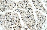 PSD3 Antibody in Immunohistochemistry (IHC)