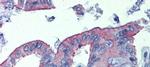 CGI58 Antibody in Immunohistochemistry (IHC)