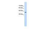 UPB1 Antibody in Western Blot (WB)